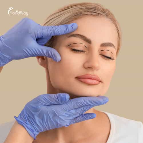 How to Get the Best Eyelid Surgery in Cali, Colombia